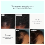 Nutrafol Women's Hair Growth Supplements, Ages 18-44, Clinically Proven for Visibly Thicker and Stronger Hair, Dermatologist Recommended - 1 Month Supply - Image 3