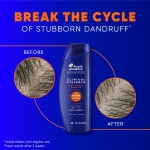 Head & Shoulders Clinical Strength Dandruff Shampoo and Conditioner Set, Dry Scalp Relief, Up to 100% Flake Protection, Selenium Sulfide Formula, 13.5 & 9.1 Fl Oz, 2 Pack - Image 5